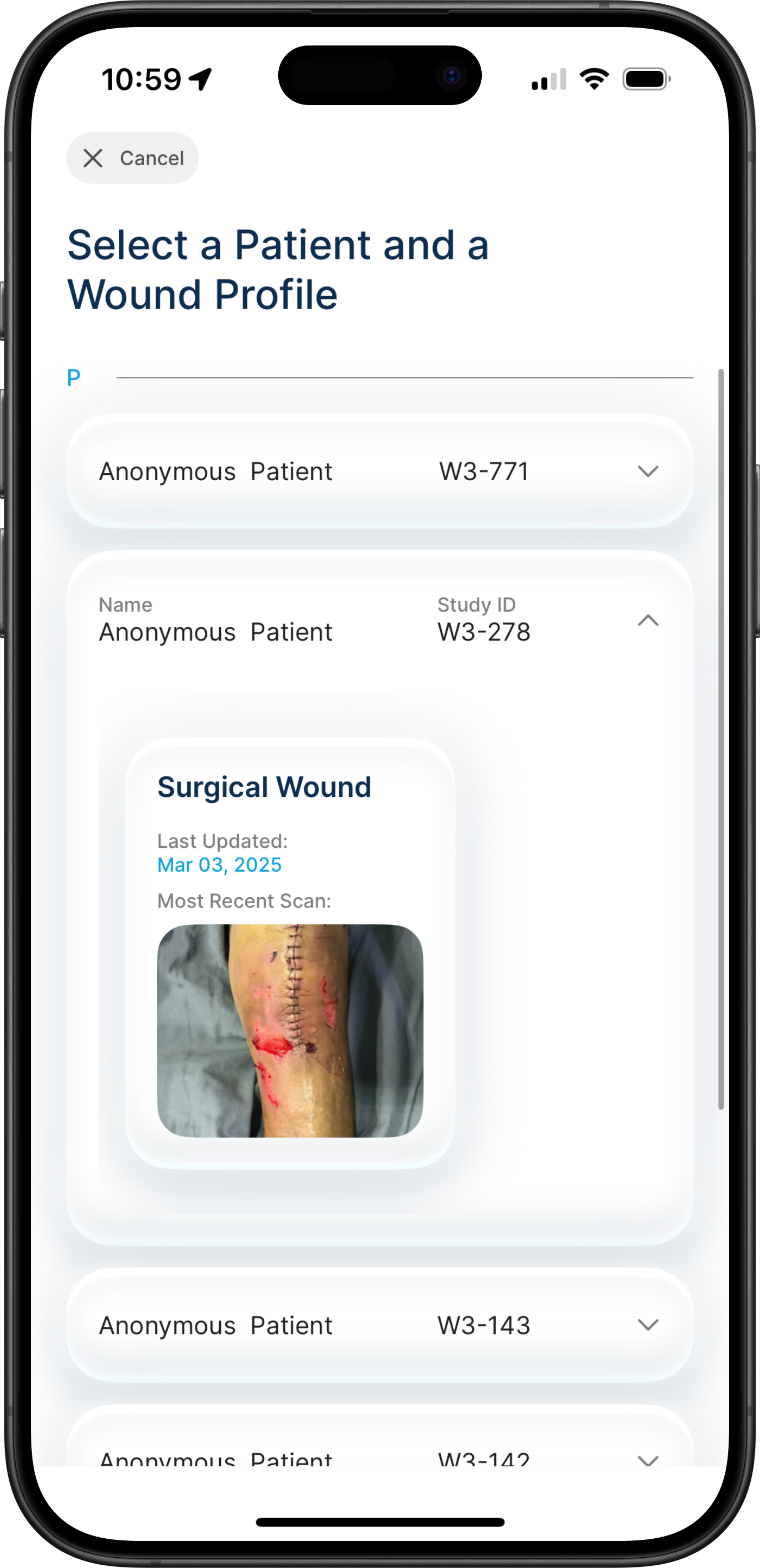 Select Patient & Wound Profile